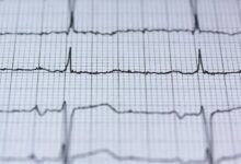 quantum pulse brand ladder